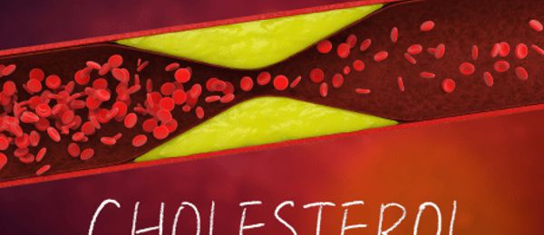 Máte pocit, že jíte zdravě, ale přesto se vám zhoršují výsledky krve nebo slyšíte, že máte vysoký cholesterol? Ne všechny tuky v krvi jsou stejné, klíčové je rozlišit, co představuje riziko a co vás naopak chrání. Vyšetření hladiny cholesterolu i jednotlivých frakcí LDL a HDL vám pomůže získat kontrolu nad zdravím srdce a cév.