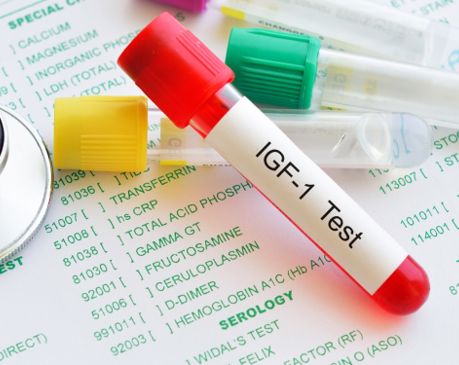 IGF-1 – hormon růstu, vitality a zdraví.Co to znamená pro vaše tělo a proč si udělat test?