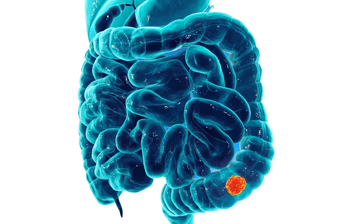 vyšetření střevního mikrobiomu